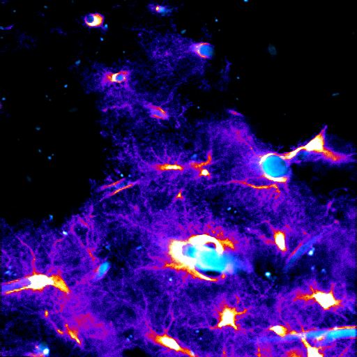Awake fluorescence microscopy example